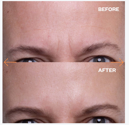 Ageless Beauty Silicone Wrinkle Patches
