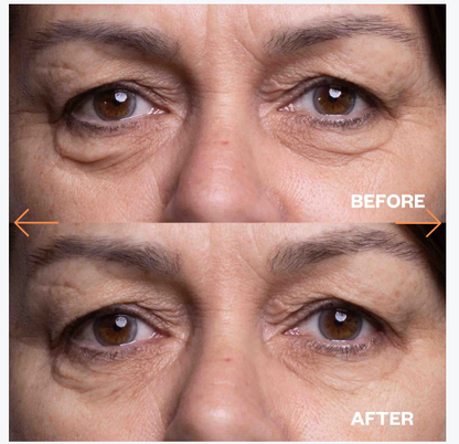 Ageless Beauty Silicone Wrinkle Patches